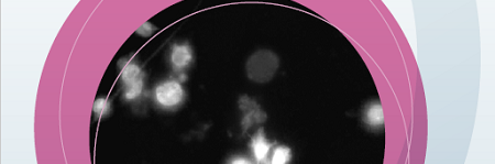 apoptoz-kitleri-429596e3c554d8d4