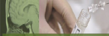 cerebrospinal-fluid-stabilisation-with-transfix-edta-480597262cd7527f