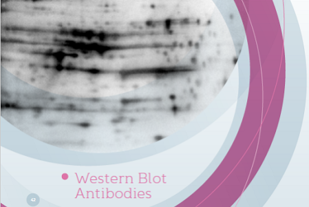westernblot-antikorlari-428596e3c4ecf3f3